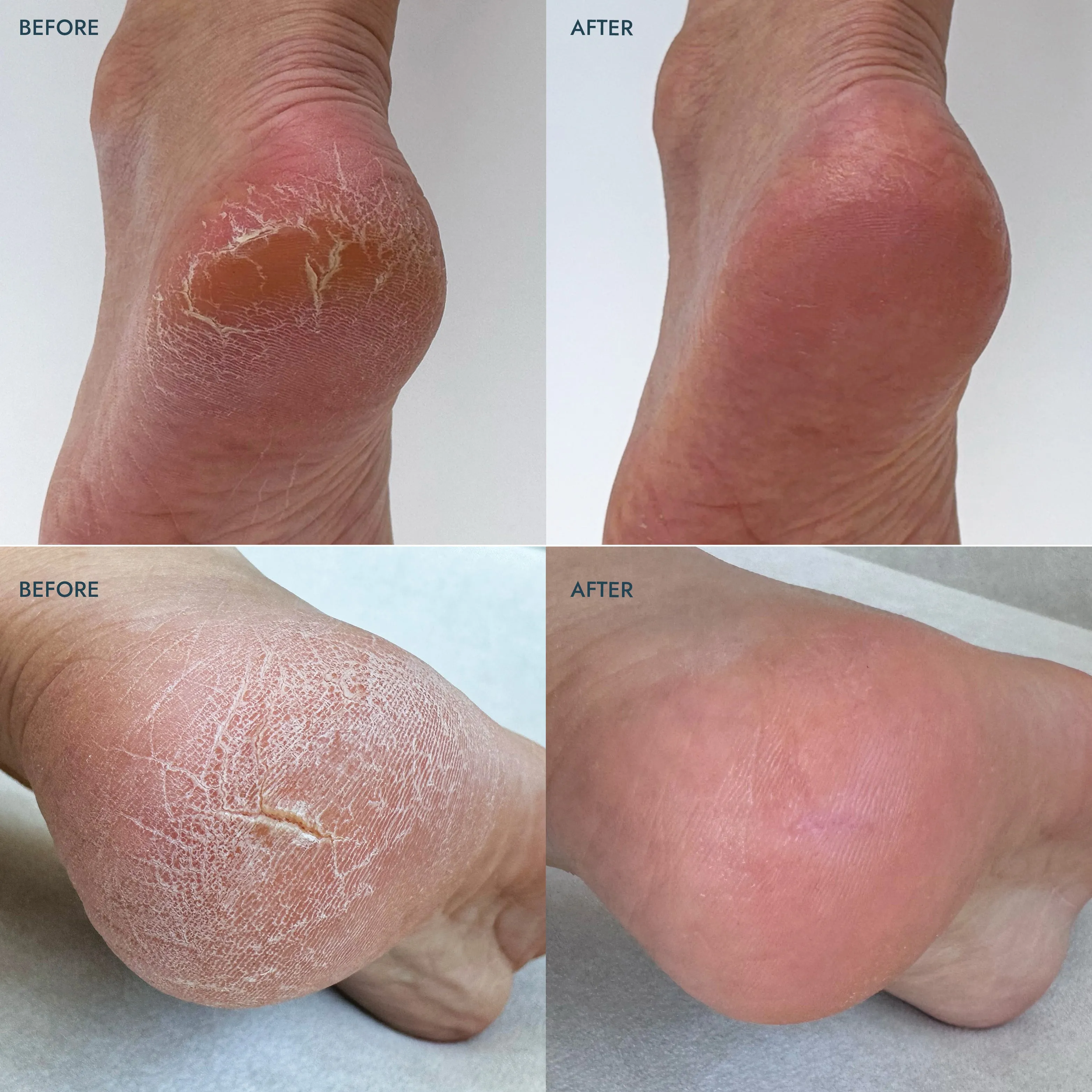 Solemate Heel Repair Balm Set - Assorted